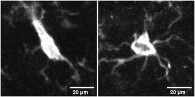 A deep learning framework for classifying microglia activation state using morphology and intrinsic fluorescence lifetime data